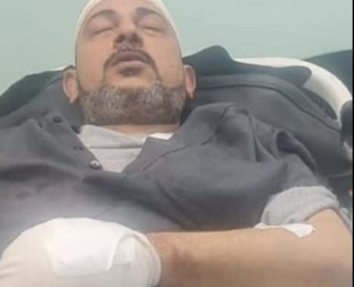 بتر يد شاب في أول أيام رمضان بالشرقية بعد مطالبته بأمواله.. والأمن يتحرك لضبط الجناة